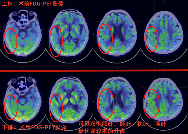 ce999ebfc8e1121226f05548ce549bb2.png